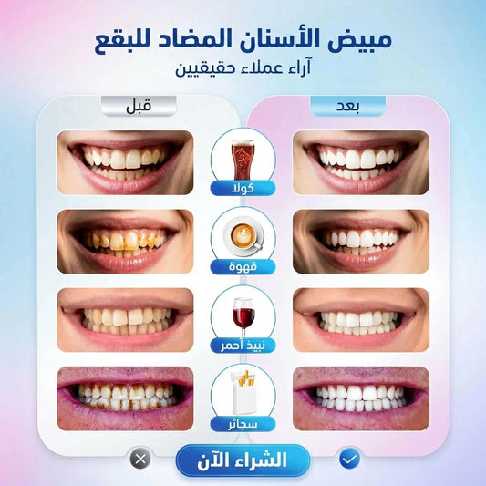 معجون تبييض الاسنان